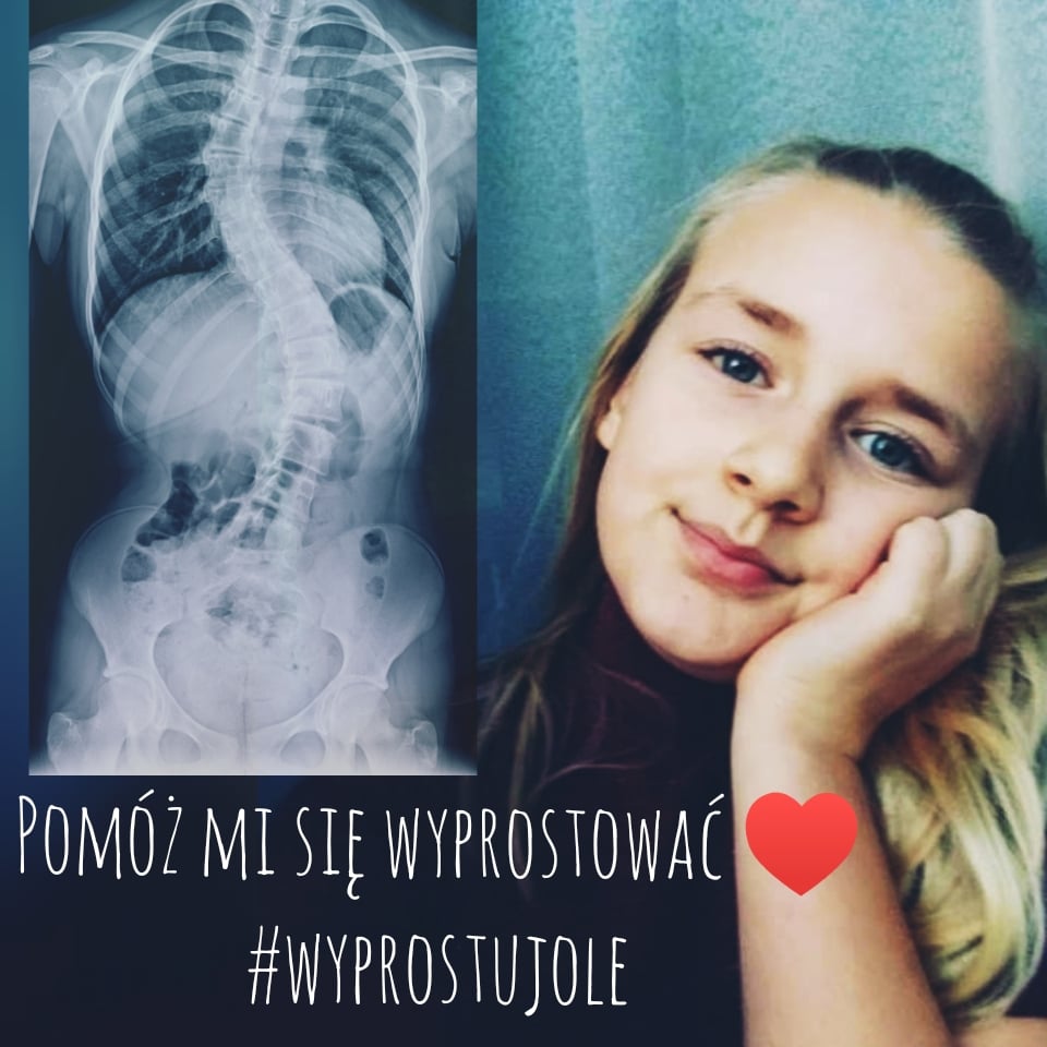 #wyprostujole. Środowisko ju-jitsu zbiera na operację czternastoletniej Oli